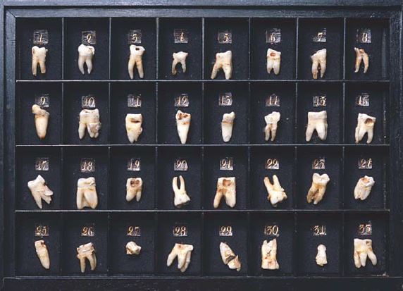 Коллекция зубов, удаленных Петром I, на экспозиции «Первые естественнонаучные коллекции Кунсткамеры». Фото: Кунсткамера. Музей антропологии и этнографии, vk.com/museumkunstkamera. 